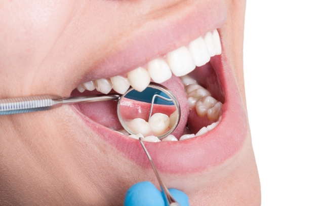 General Dental Care